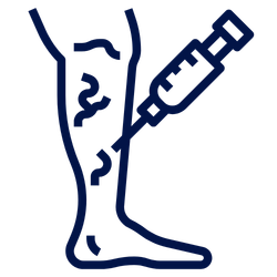 Sclerotherapy